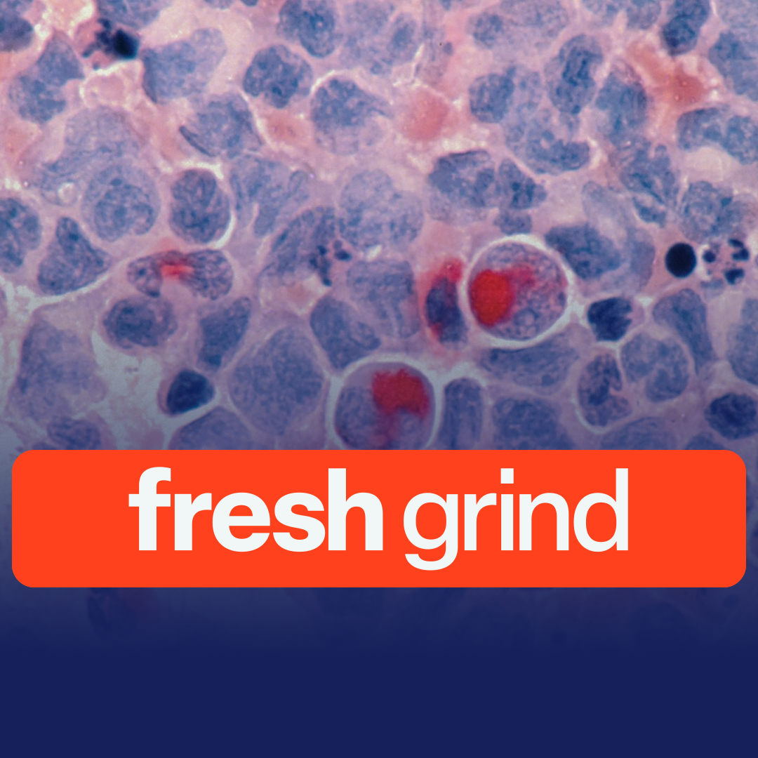 Myrio’s Cancer Therapy Approved for Human Trials